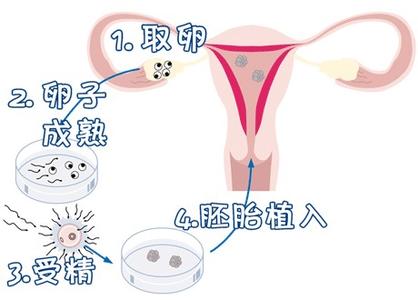 Geri培养箱